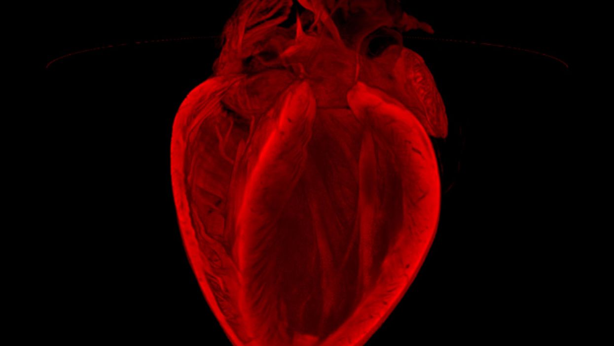 'The broken heart': This image reveals the remarkable 3D structure of an adult mouse heart. The optical projection tomography (OPT) technique used here is being developed to allow us to better measure the extent of injury after heart attack, and to assess repair.