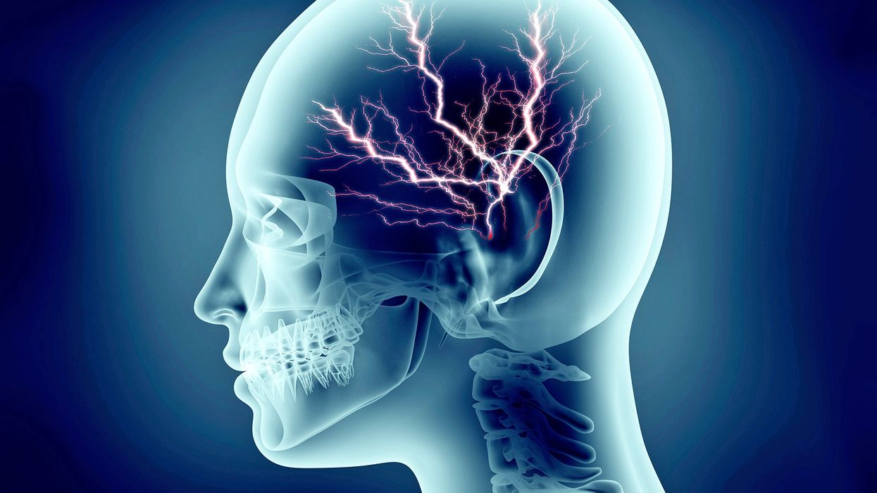 The potential for EEG devices lies far beyond monitoring brain activity