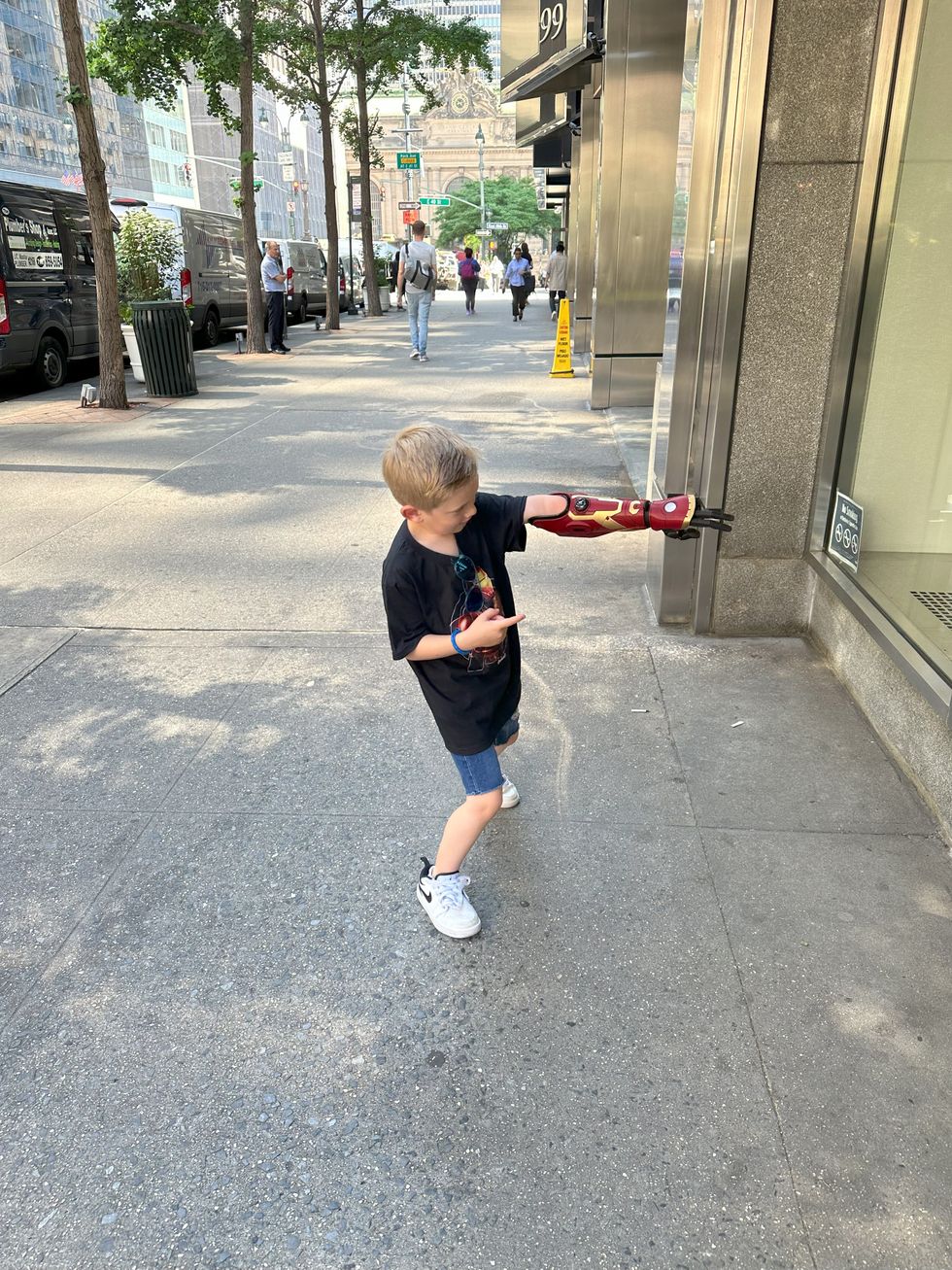 The prosthetic uses special sensors which detect muscular contractions and turn them into bionic hand movements. (Ashley Marotta/ PA)