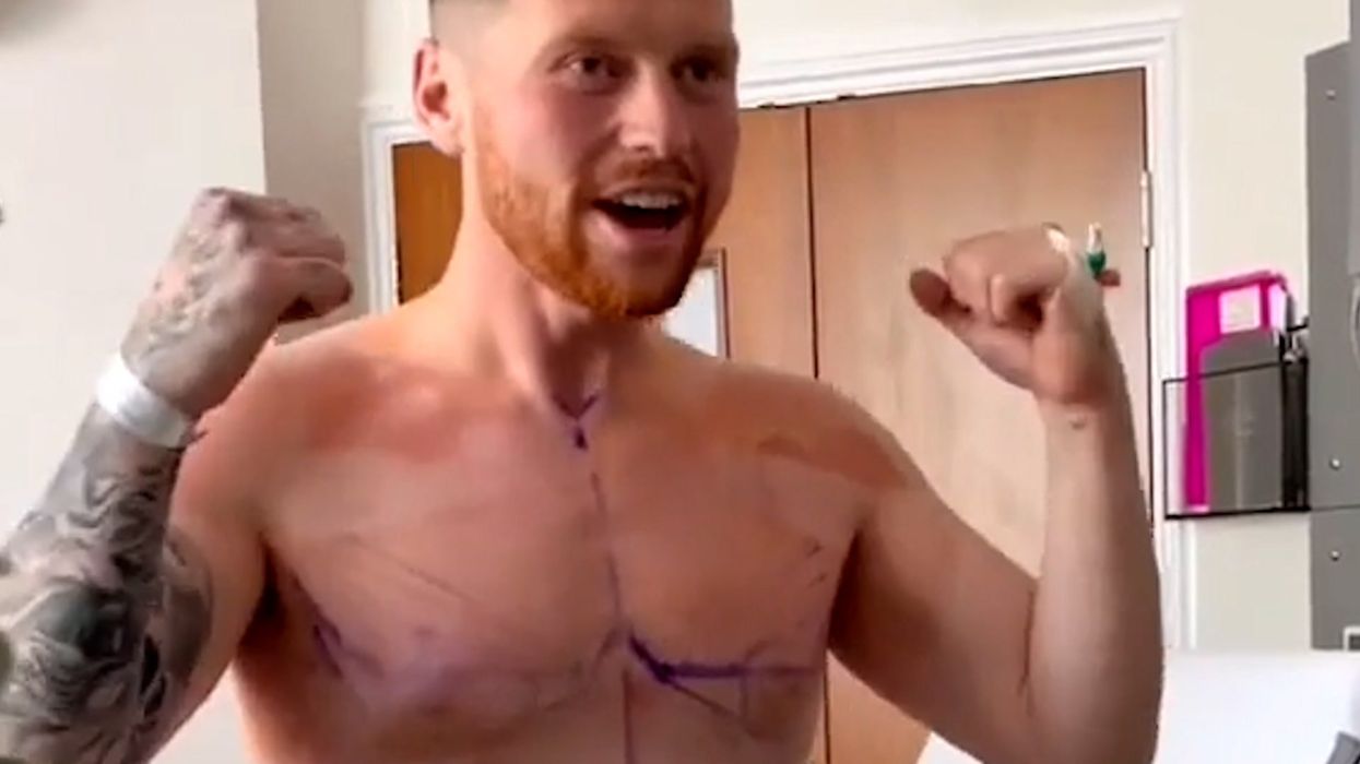 Sidemen member praised for showing his 'vulnerability' by documenting tummy tuck