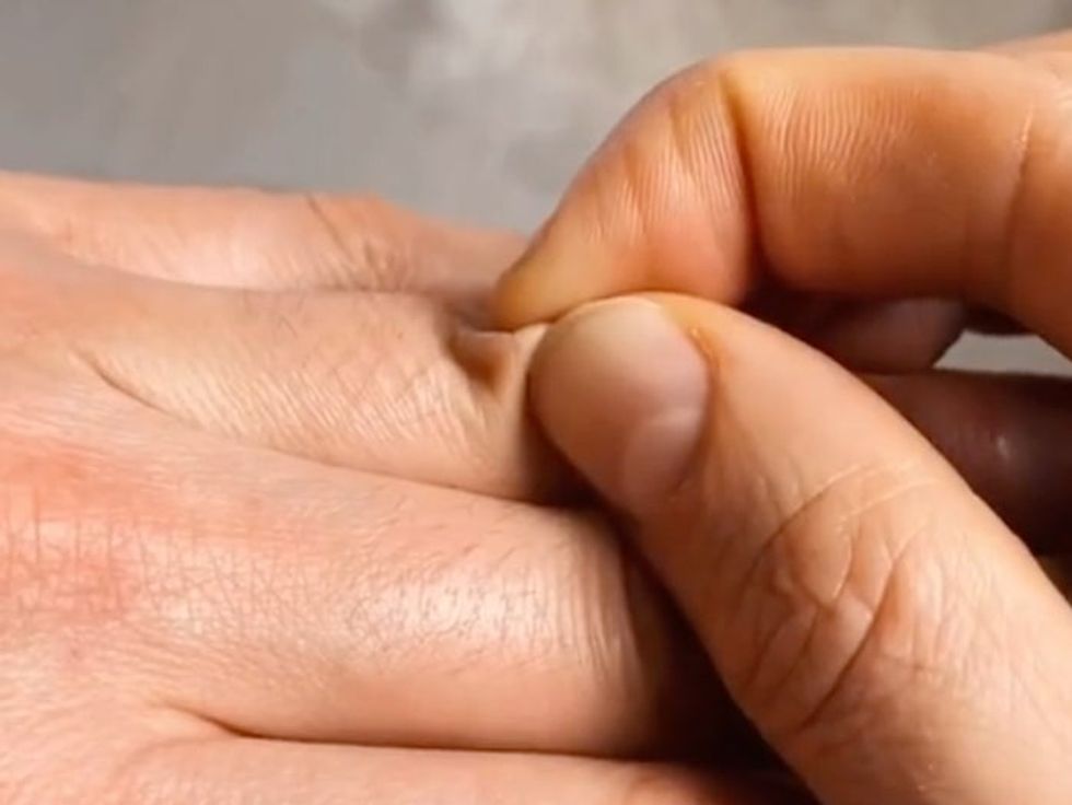 This TikTok ‘skin pinch’ test will tell if you’re dehydrated in seconds