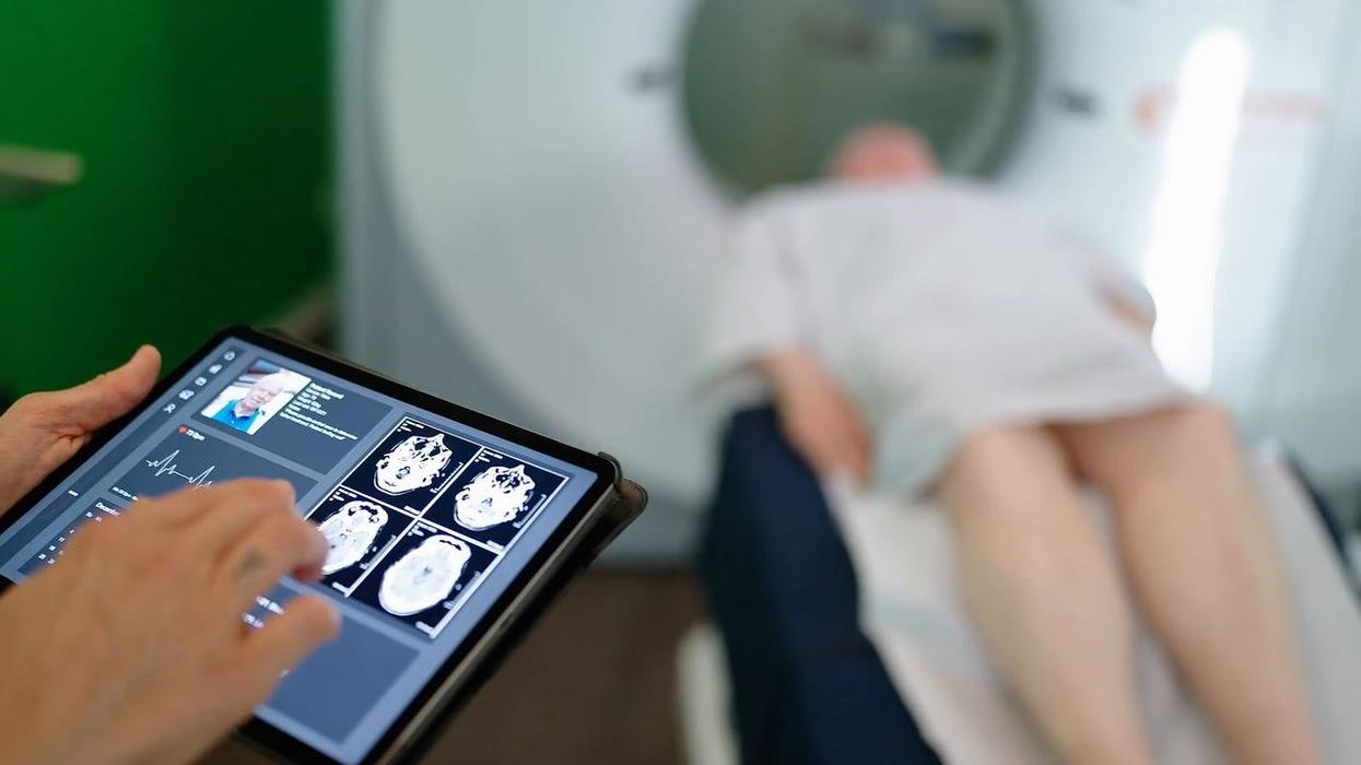 Why do younger generations have bigger brains?