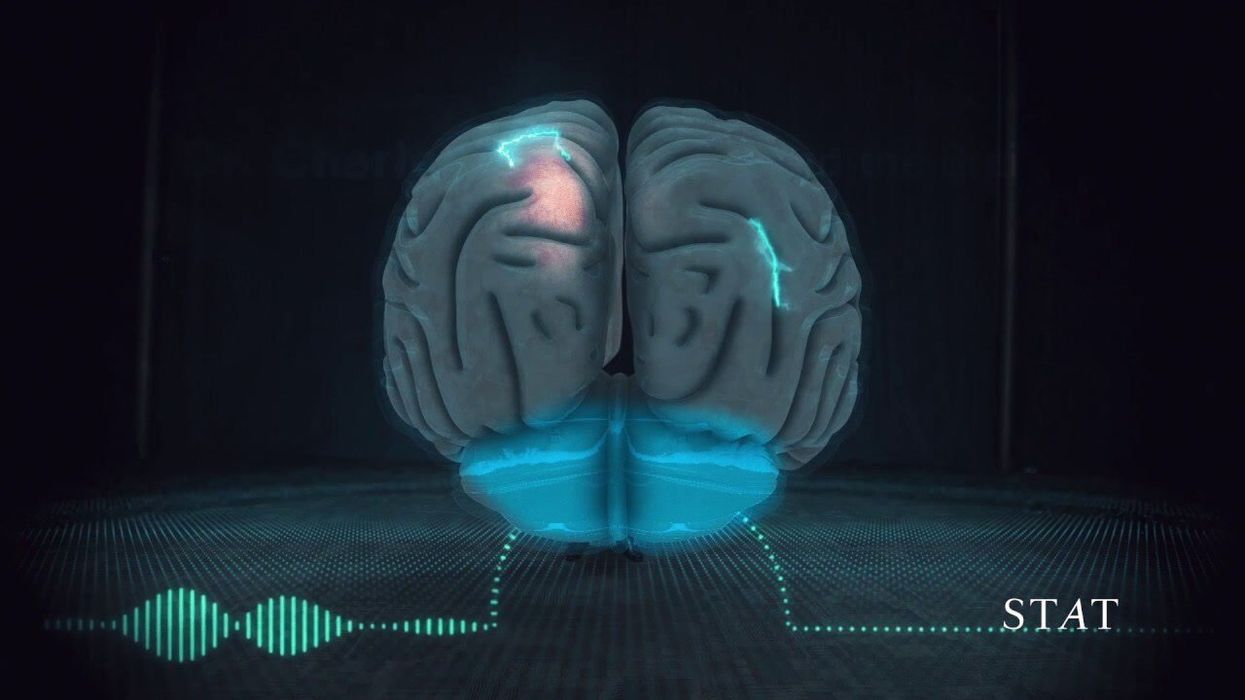 How your job could be causing you brain damage