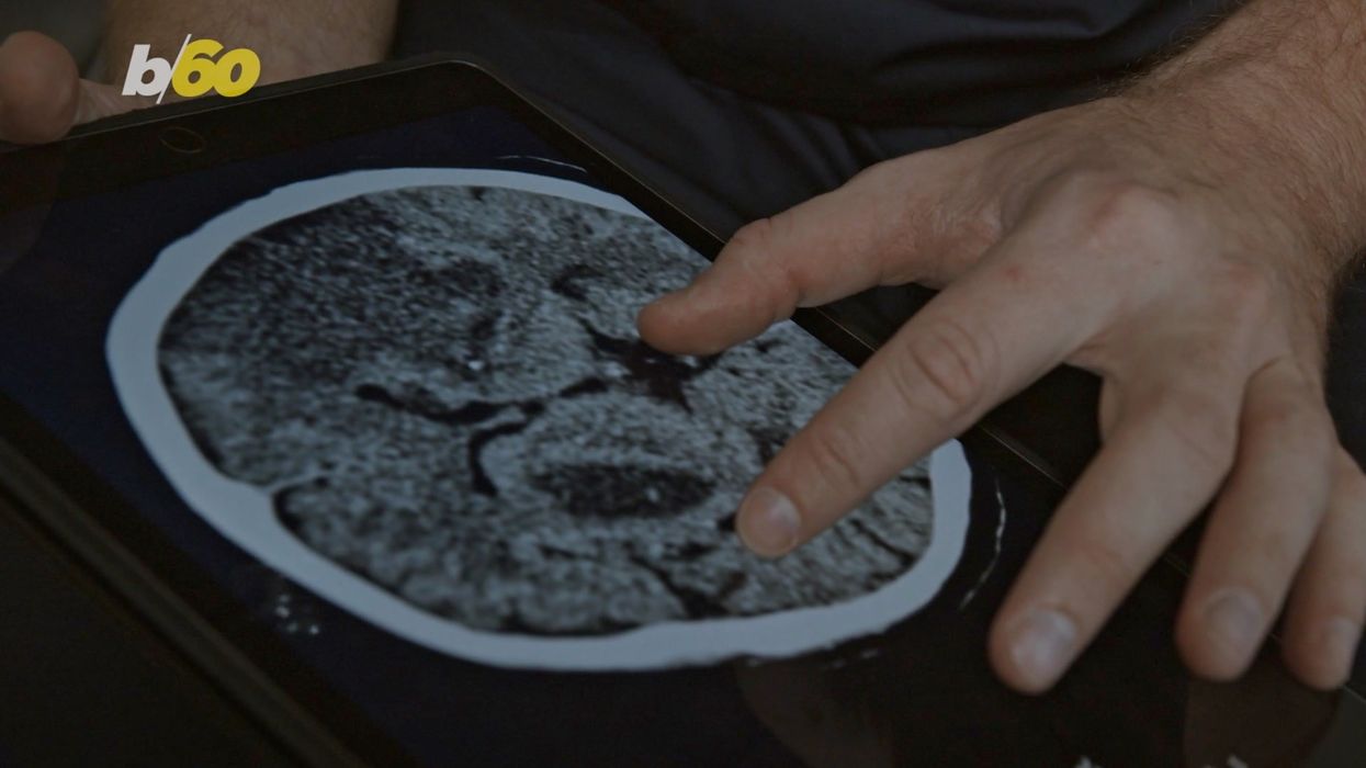 Dementia could be treated by manipulating brain waves as we sleep