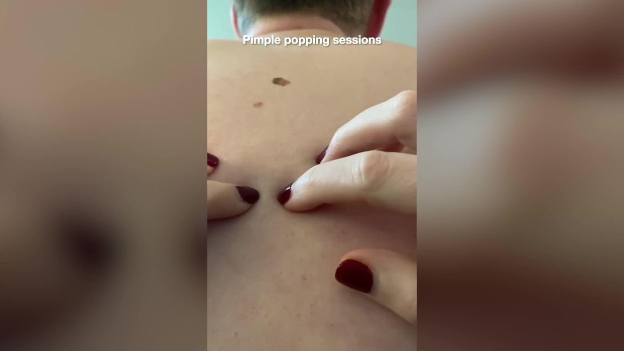 Man's live saved from cancerous mole thanks to one second TikTok clip
