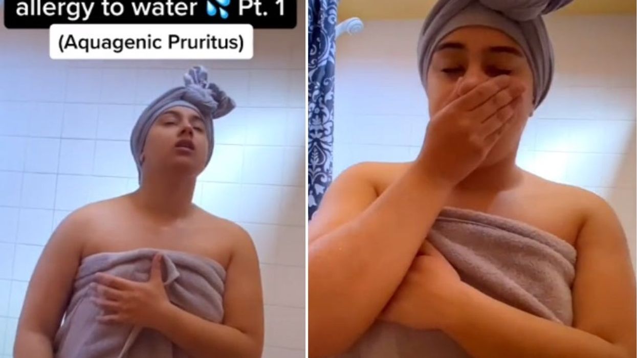 <p>TikToker Niah Selway shares the realities of taking a shower as someone with the water allergy, Aquagenic Pruritus</p>