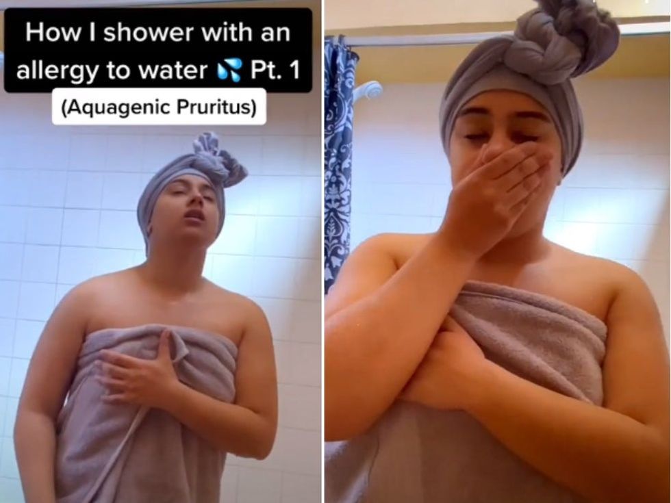<p>TikToker Niah Selway shares the realities of taking a shower as someone with the water allergy, Aquagenic Pruritus</p>