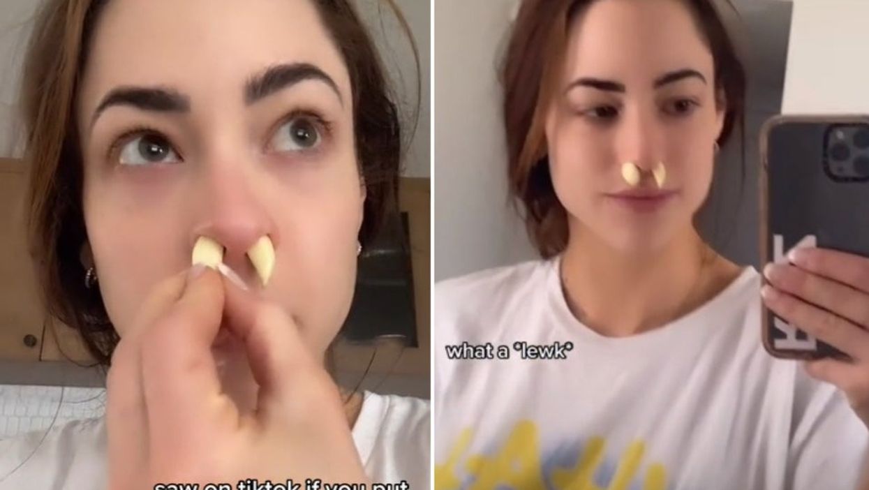 <p>TikToker Rozaline Katherine went viral after trying our the garlic “hack”</p>