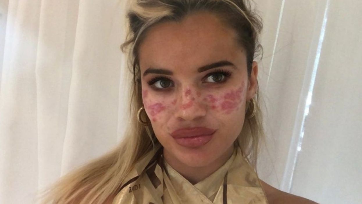 <p>Tilly Whitfield has warned fans against trying so-called DIY beauty hacks</p>