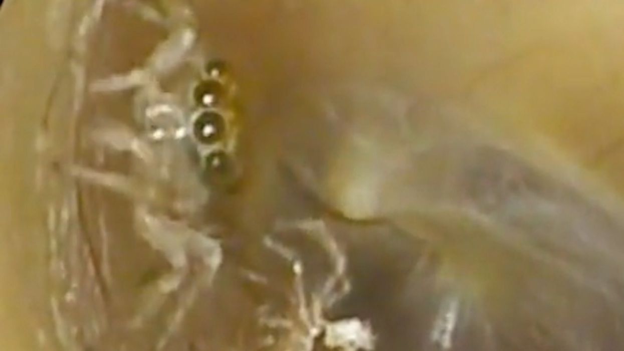 Woman captures moment she learnt a spider was living in her ear on TikTok