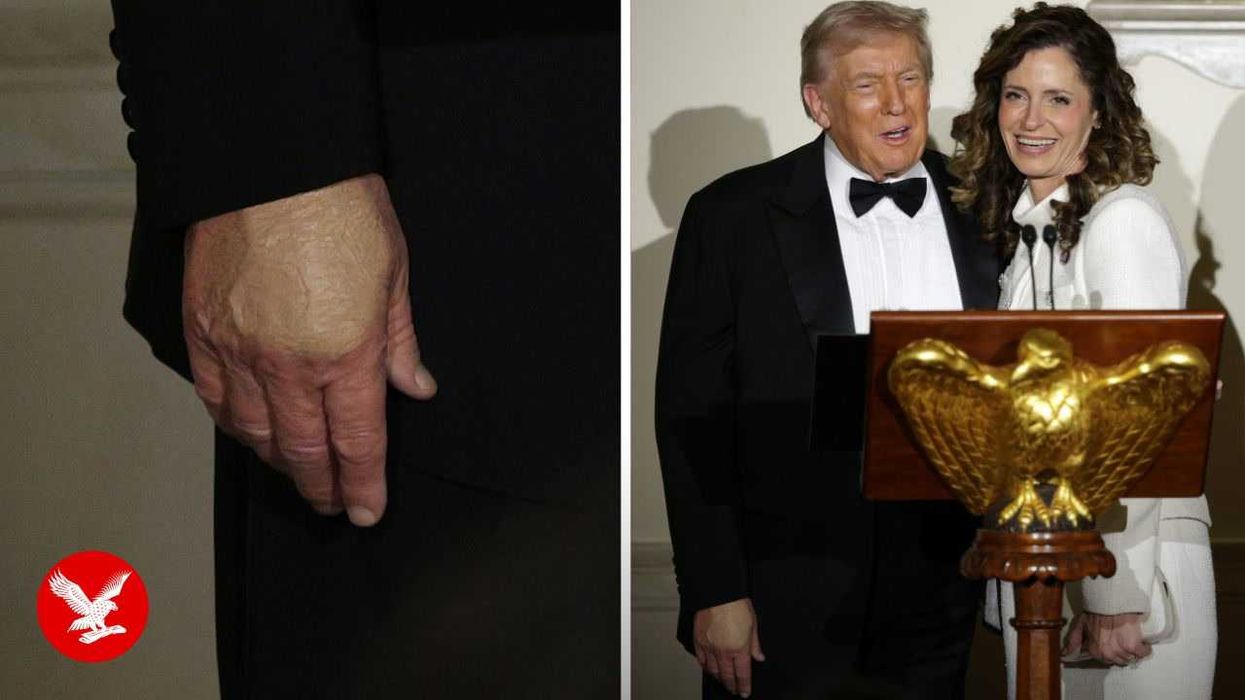 White House issues fresh explanation for Trump’s covered hand