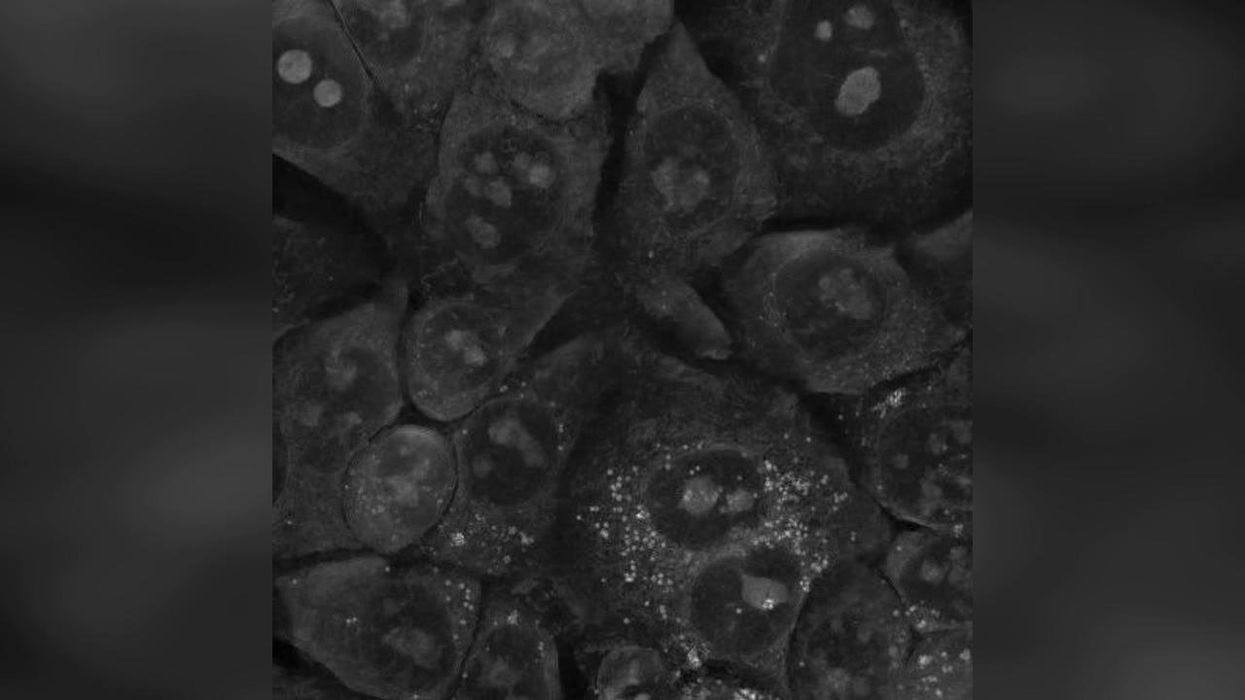 Scientists discover single cell creatures can learn new behaviours despite having no nervous system