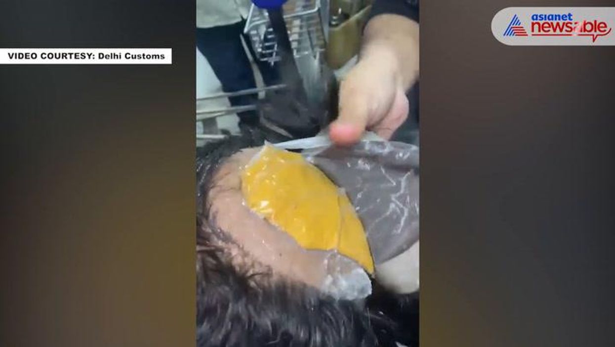 Man who smuggled 2lbs of gold in his bum arrested at airport