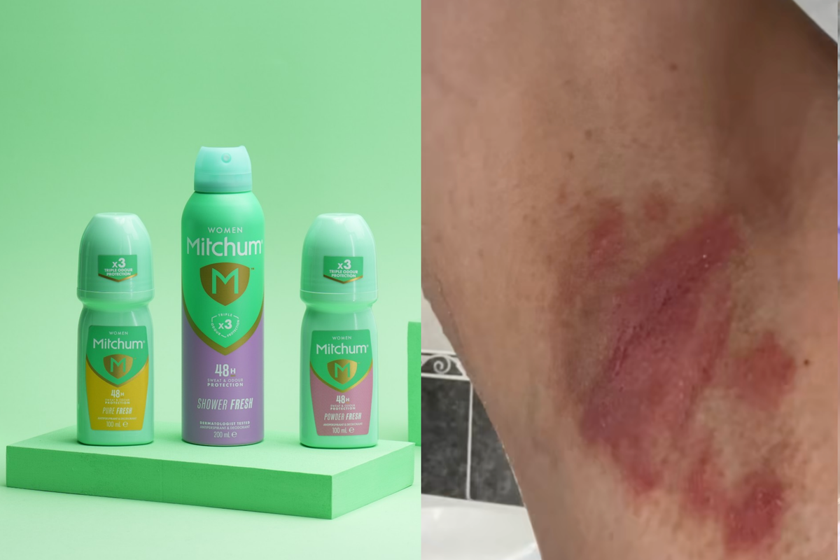 What has Mitchum said about deodorant scandal? Hundreds document ‘burnt’ skin after dodgy batch