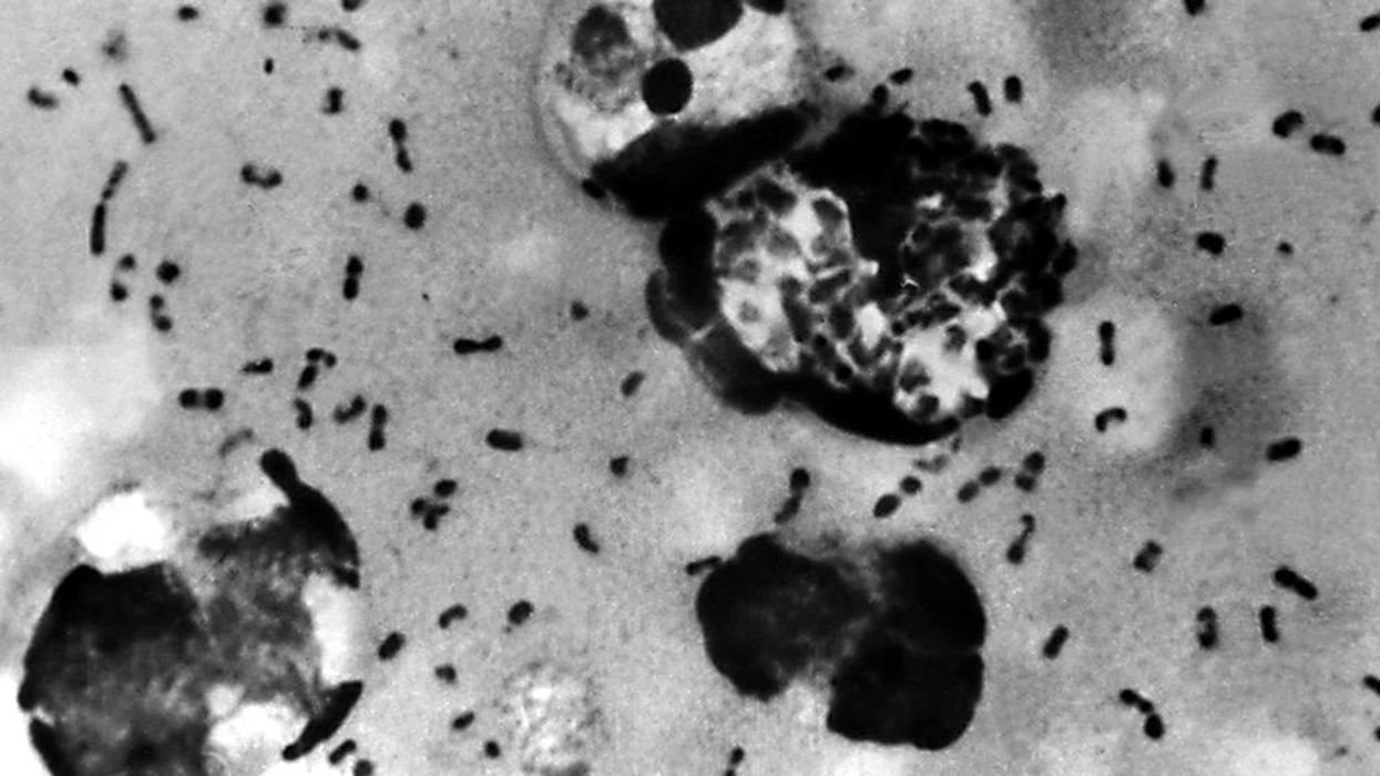 What is going on with Strep A and scarlet fever in the UK?