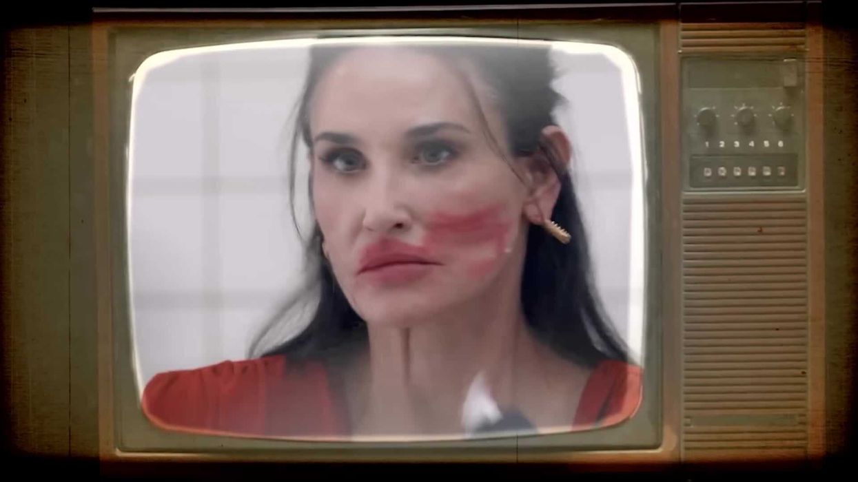 Researchers are worried Botox is changing key human behaviour - and there's science behind it