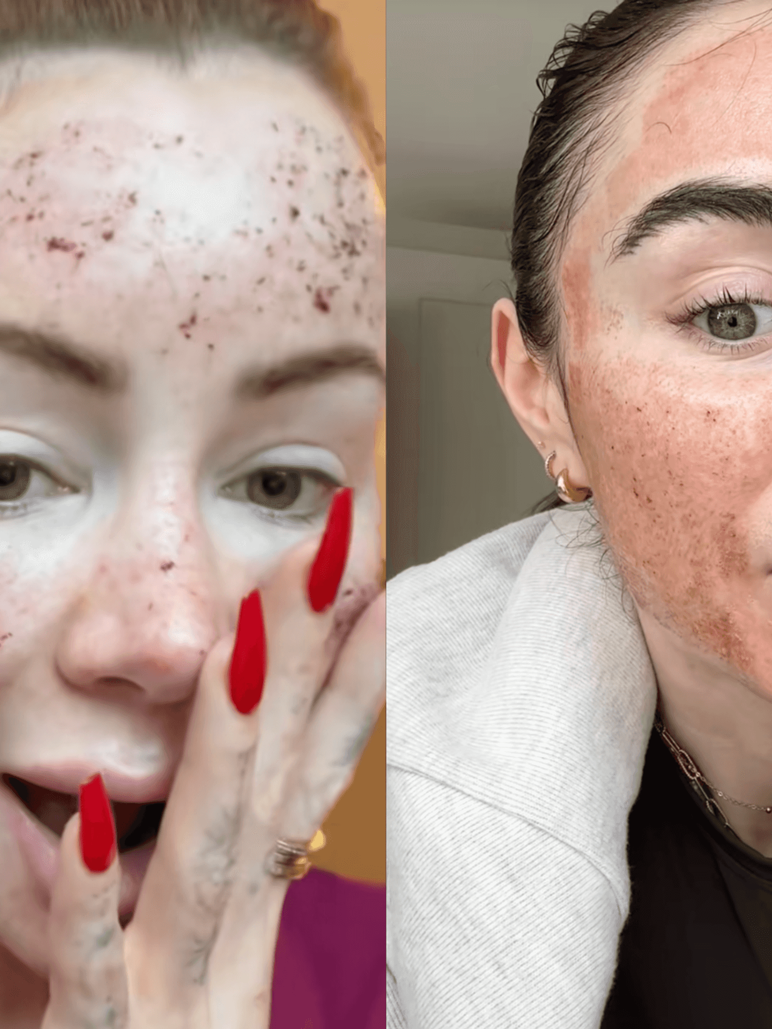 No, your favourite celebrities aren't 'burning' their skin off - here's what to know about CO2 laser