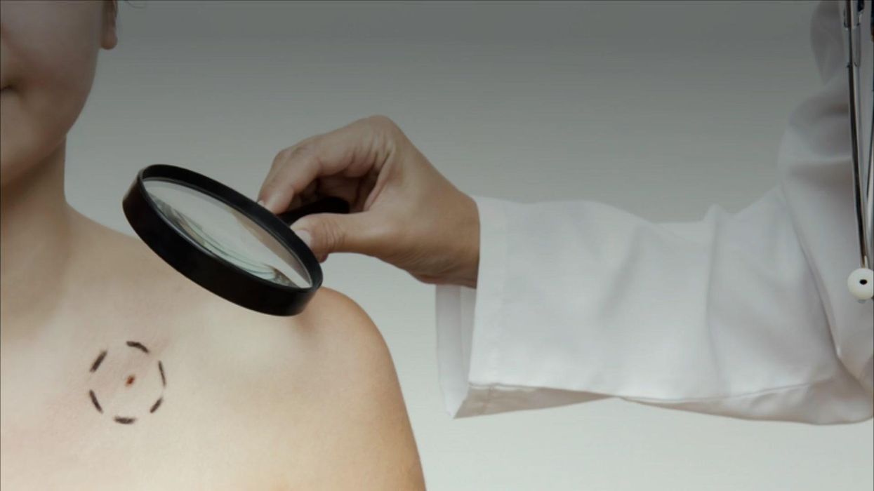 A vaccine for cancer might be available by 2030