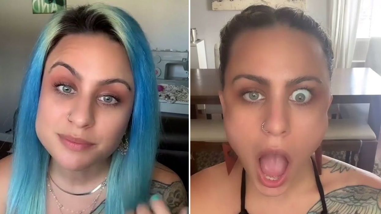 Super rare condition links woman's eye movements to her jaw