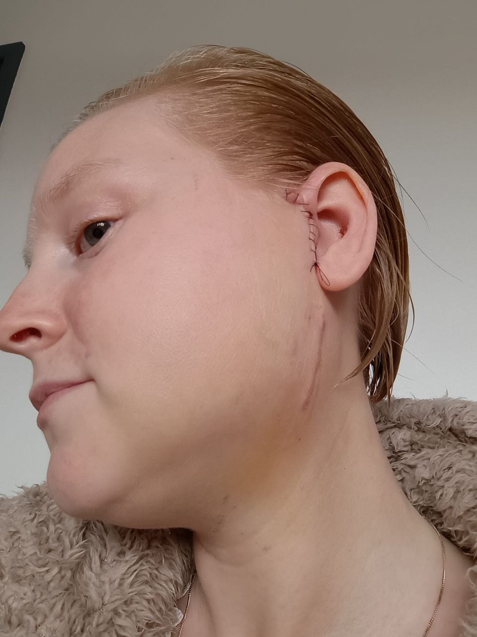 Woman showing side of face