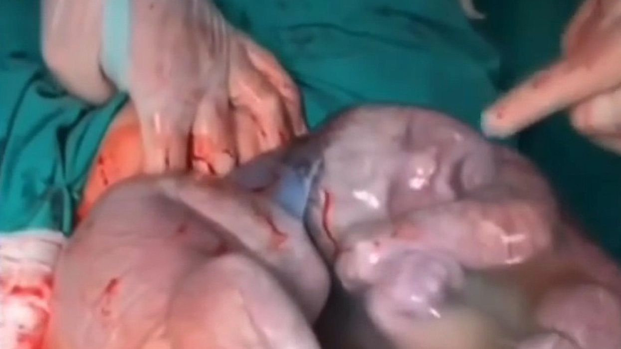 Taste of kale makes unborn babies grimace in womb