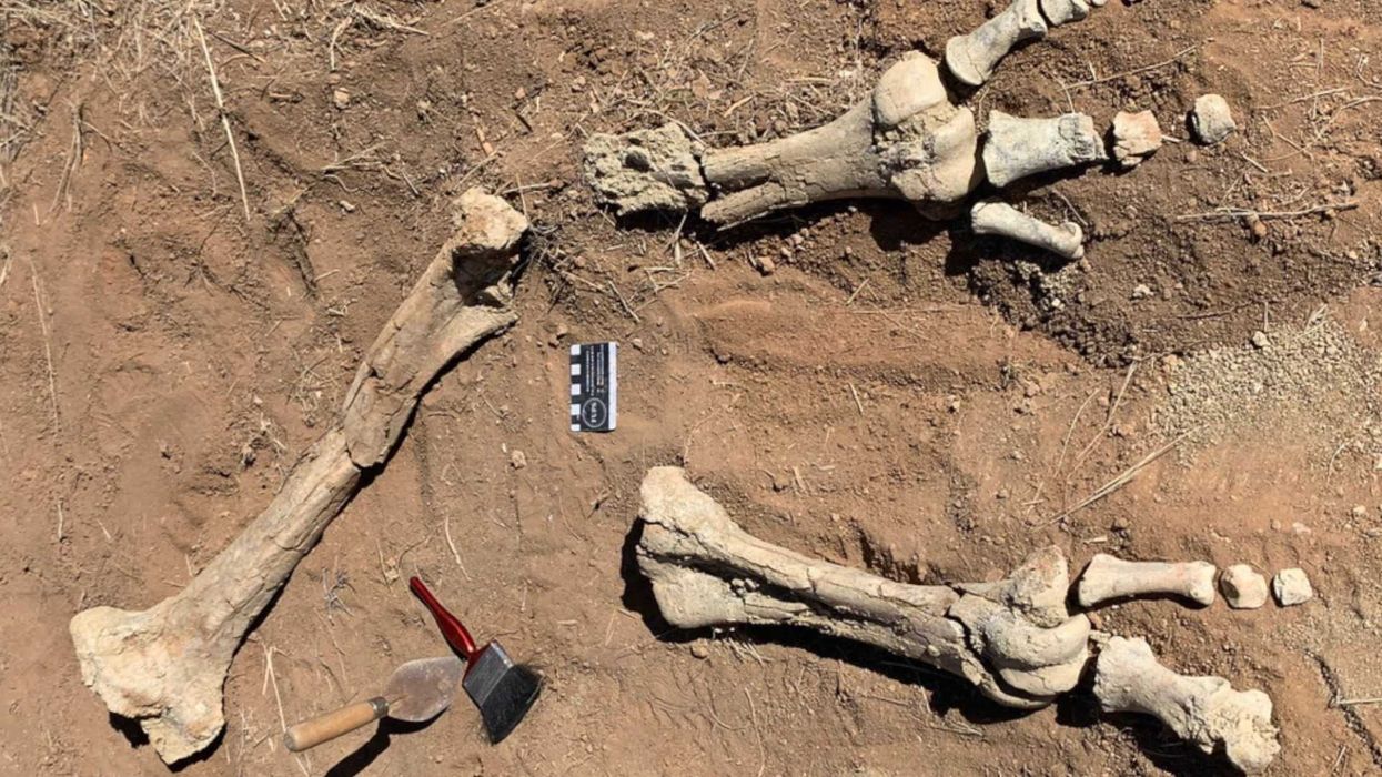 China's new 'bone glue' for instantly healing fractures has been hailed 'genius'