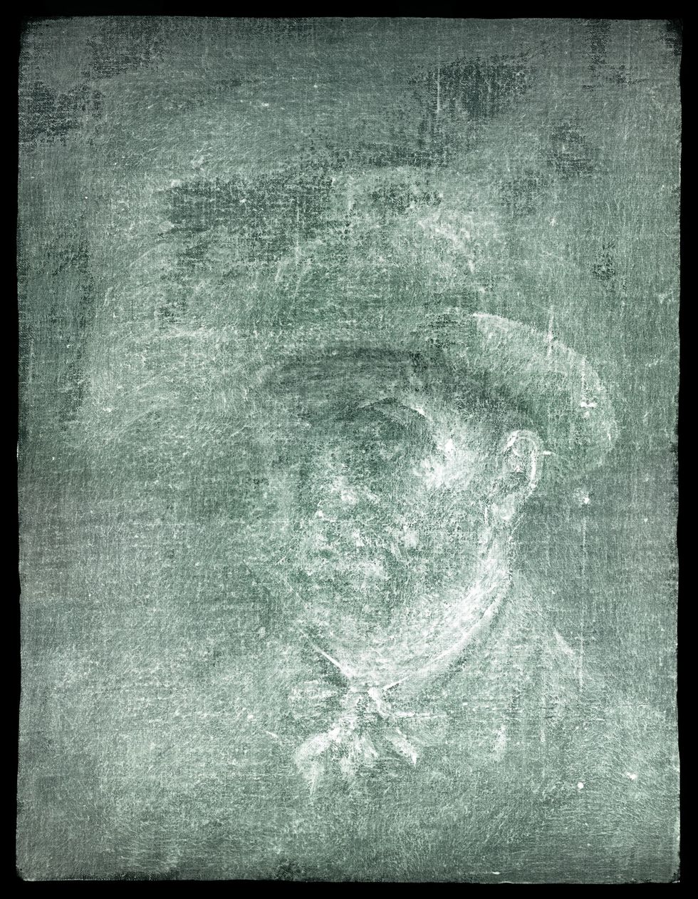X-ray image believed to show a self-portrait of Vincent Van Gogh