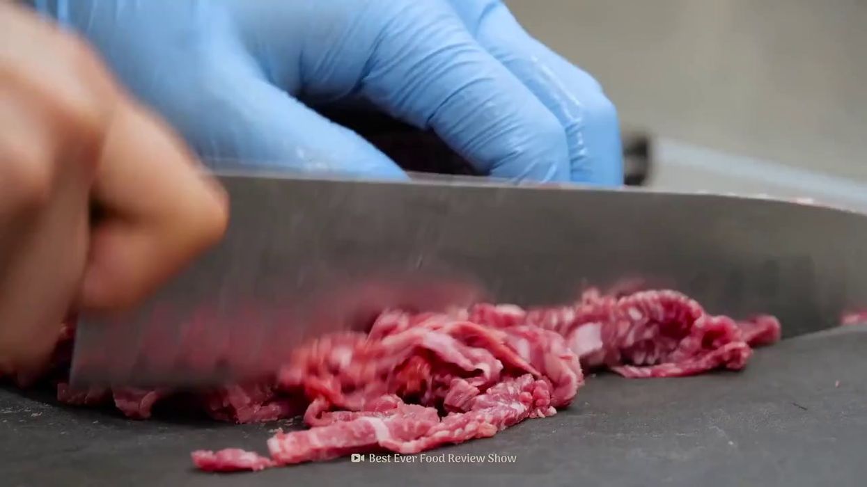 Woman claims she 'ate her own rib' after surgery – and the internet officially needs a minute