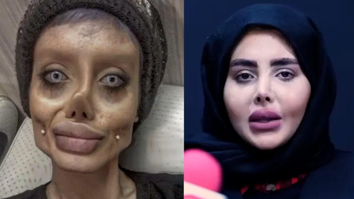 'Zombie Angelina Jolie’ shows real face after release from Iran jail